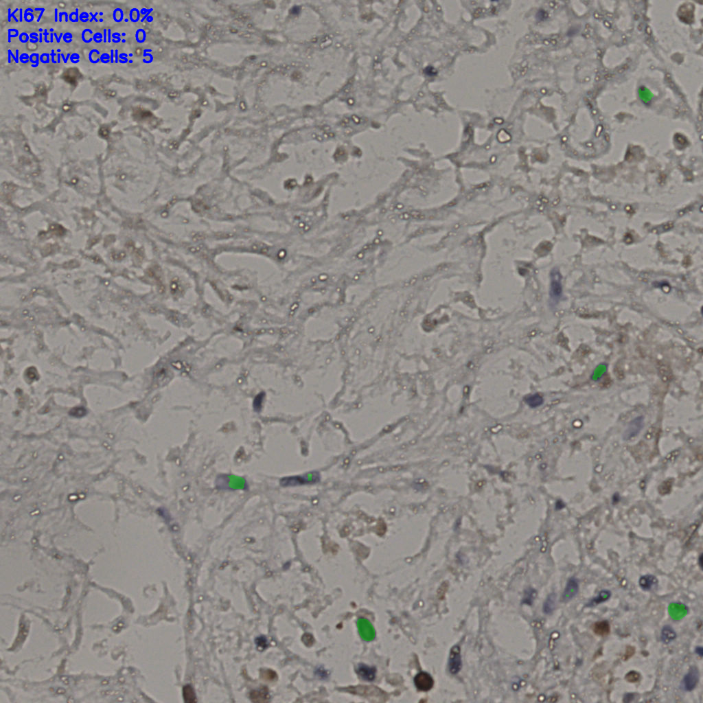 slice_21_33_x18816_y29568.png