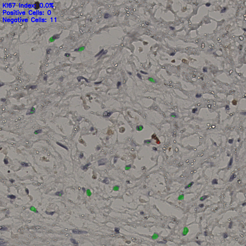 slice_21_35_x18816_y31360.png