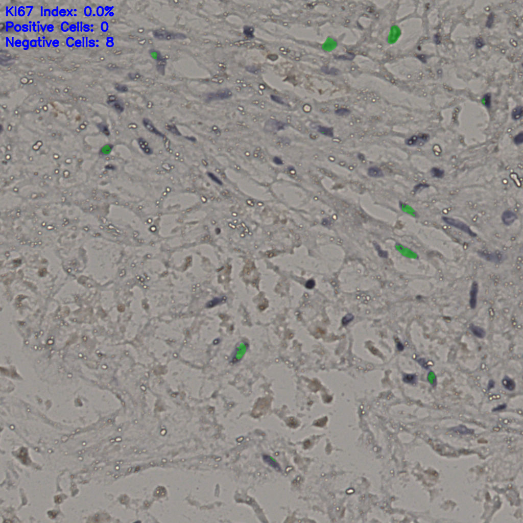slice_21_36_x18816_y32256.png