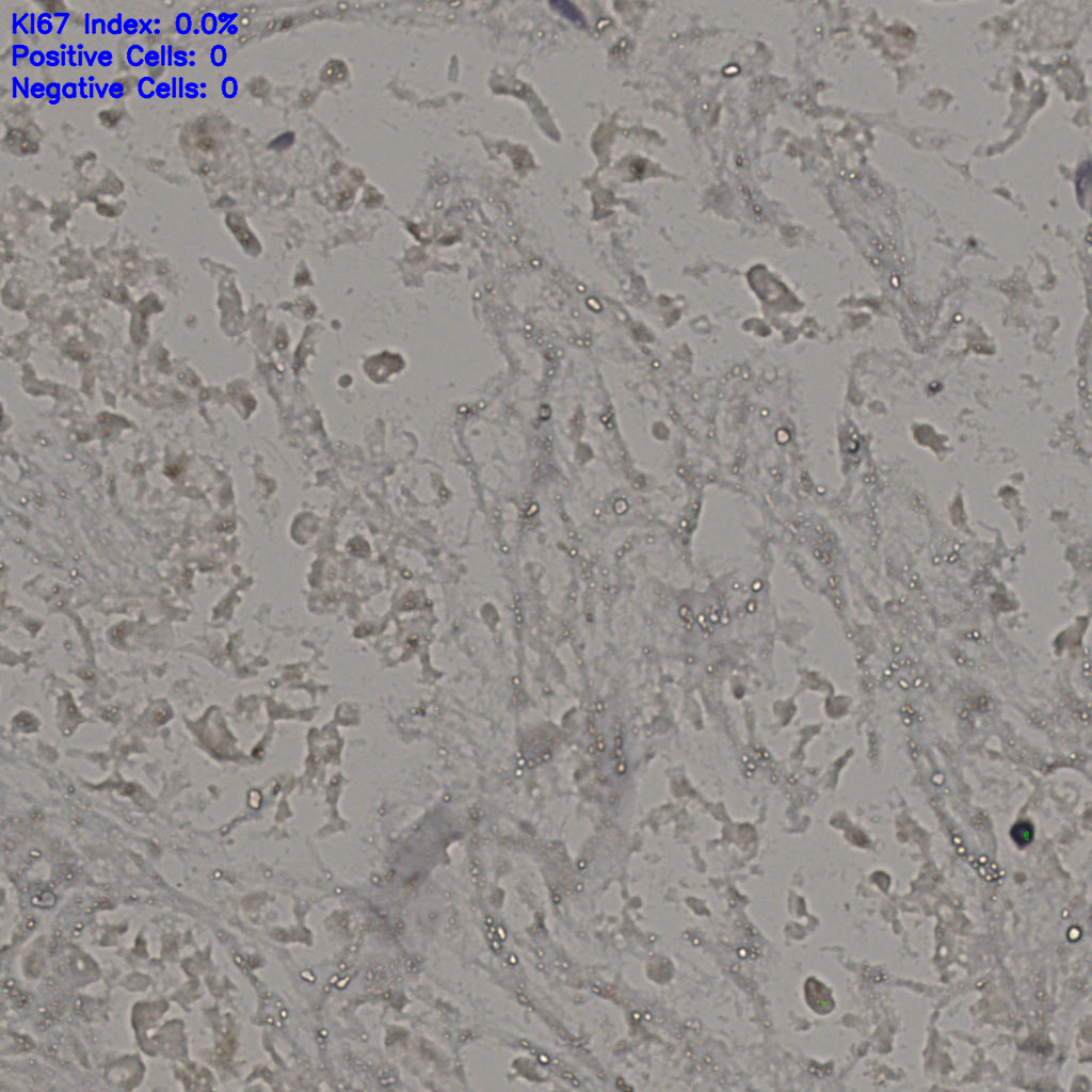 slice_21_37_x18816_y33152.png