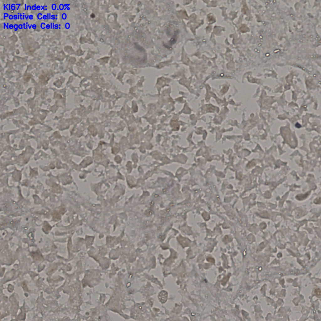 slice_21_39_x18816_y34944.png