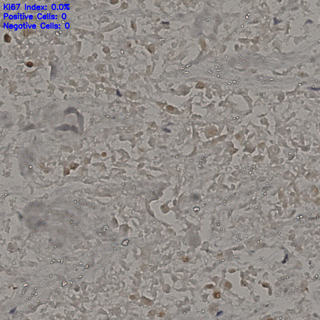 slice_21_42_x18816_y37632.png