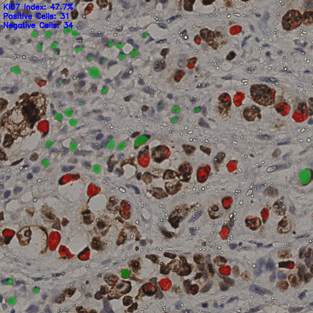 slice_21_45_x18816_y40320.png
