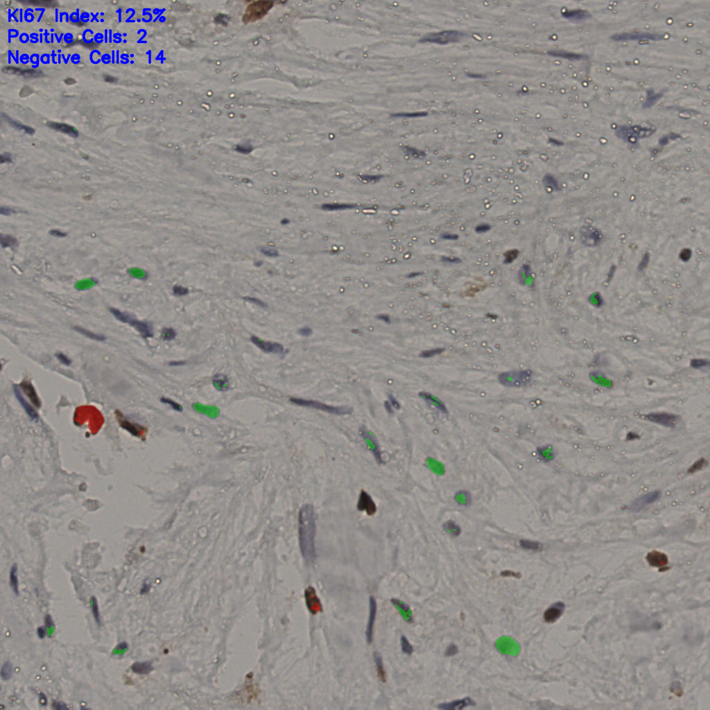 slice_21_50_x18816_y44800.png