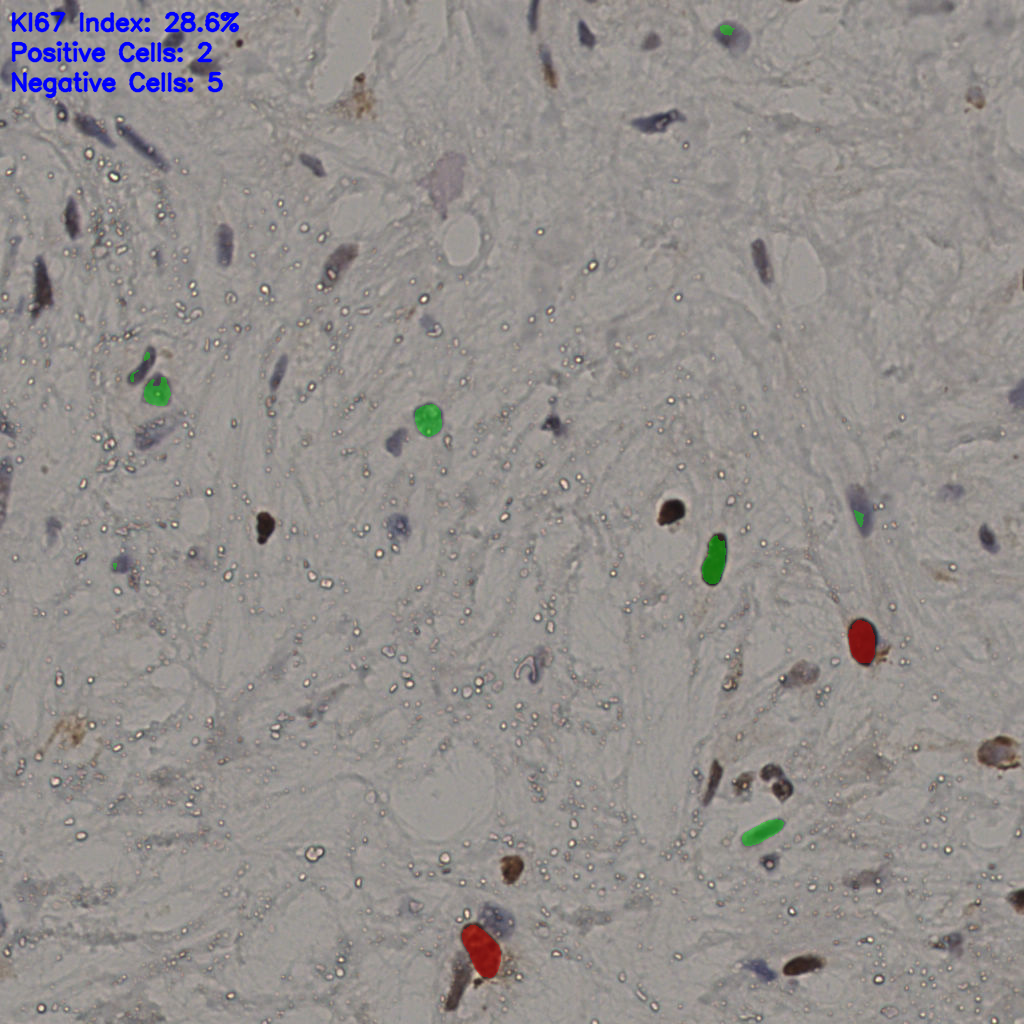 slice_21_51_x18816_y45696.png