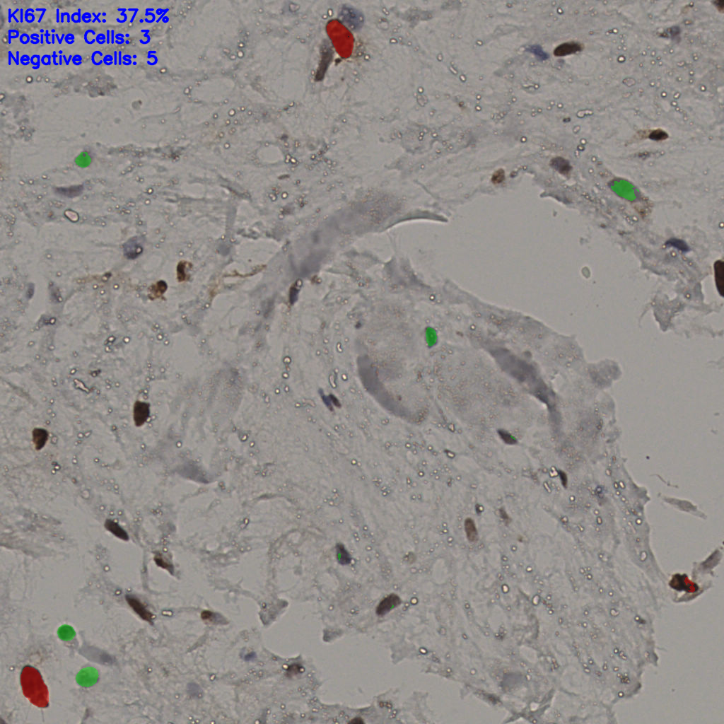 slice_21_52_x18816_y46592.png