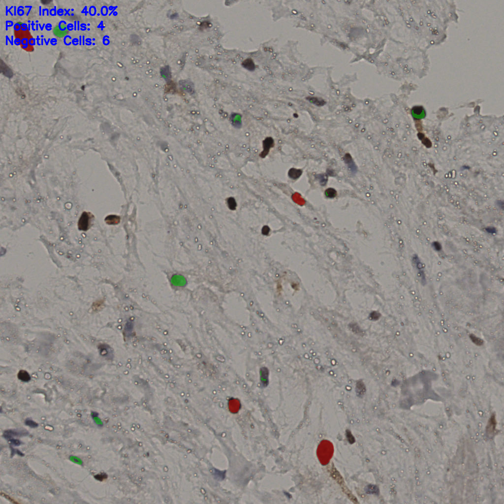 slice_21_53_x18816_y47488.png