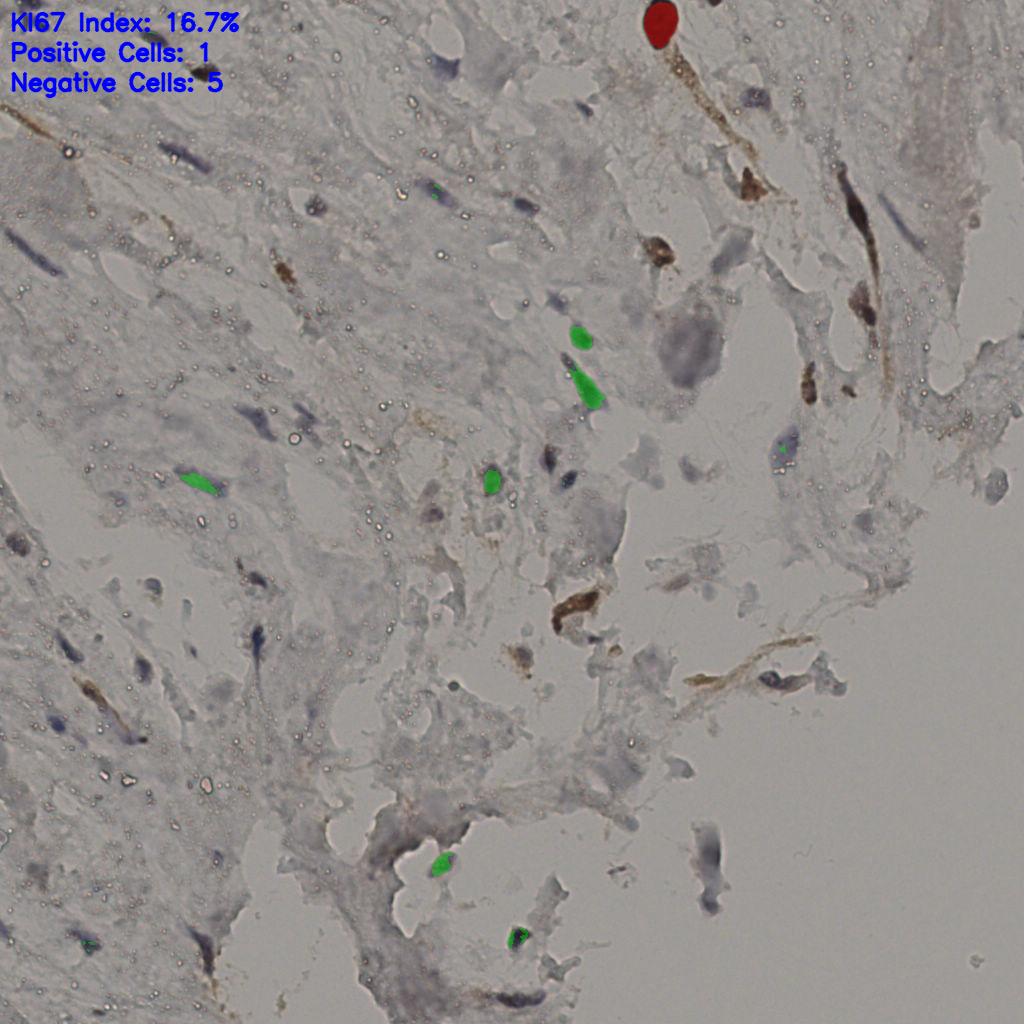 slice_21_54_x18816_y48384.png