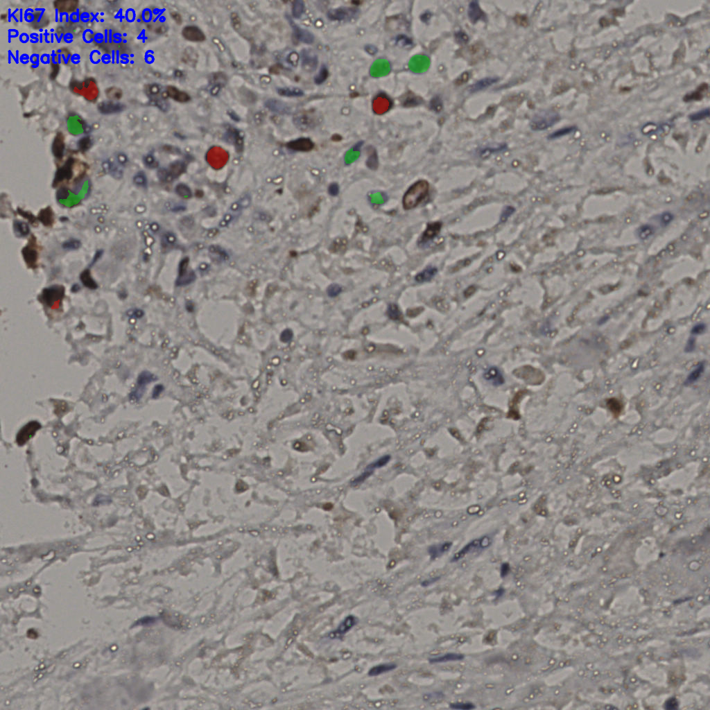 slice_22_28_x19712_y25088.png