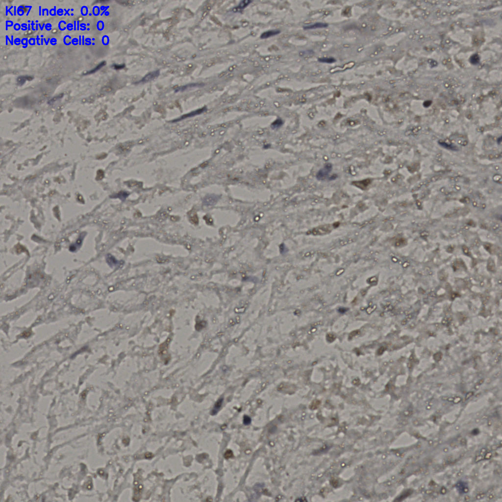 slice_22_29_x19712_y25984.png
