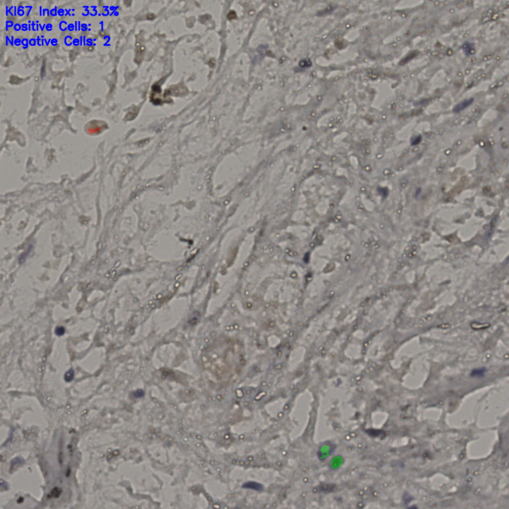 slice_22_30_x19712_y26880.png