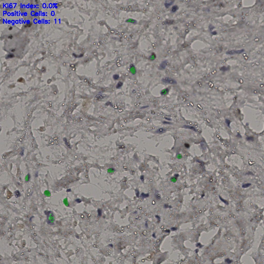 slice_22_31_x19712_y27776.png