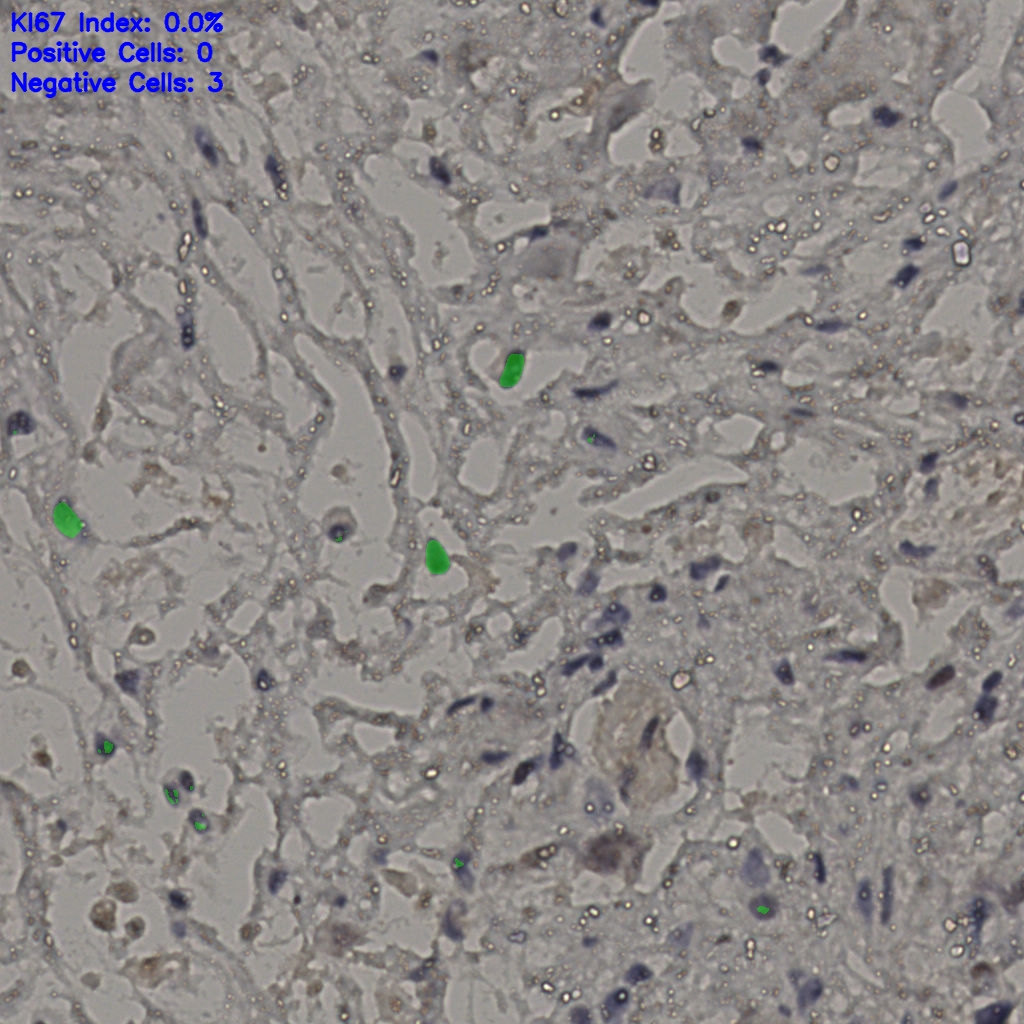 slice_22_32_x19712_y28672.png