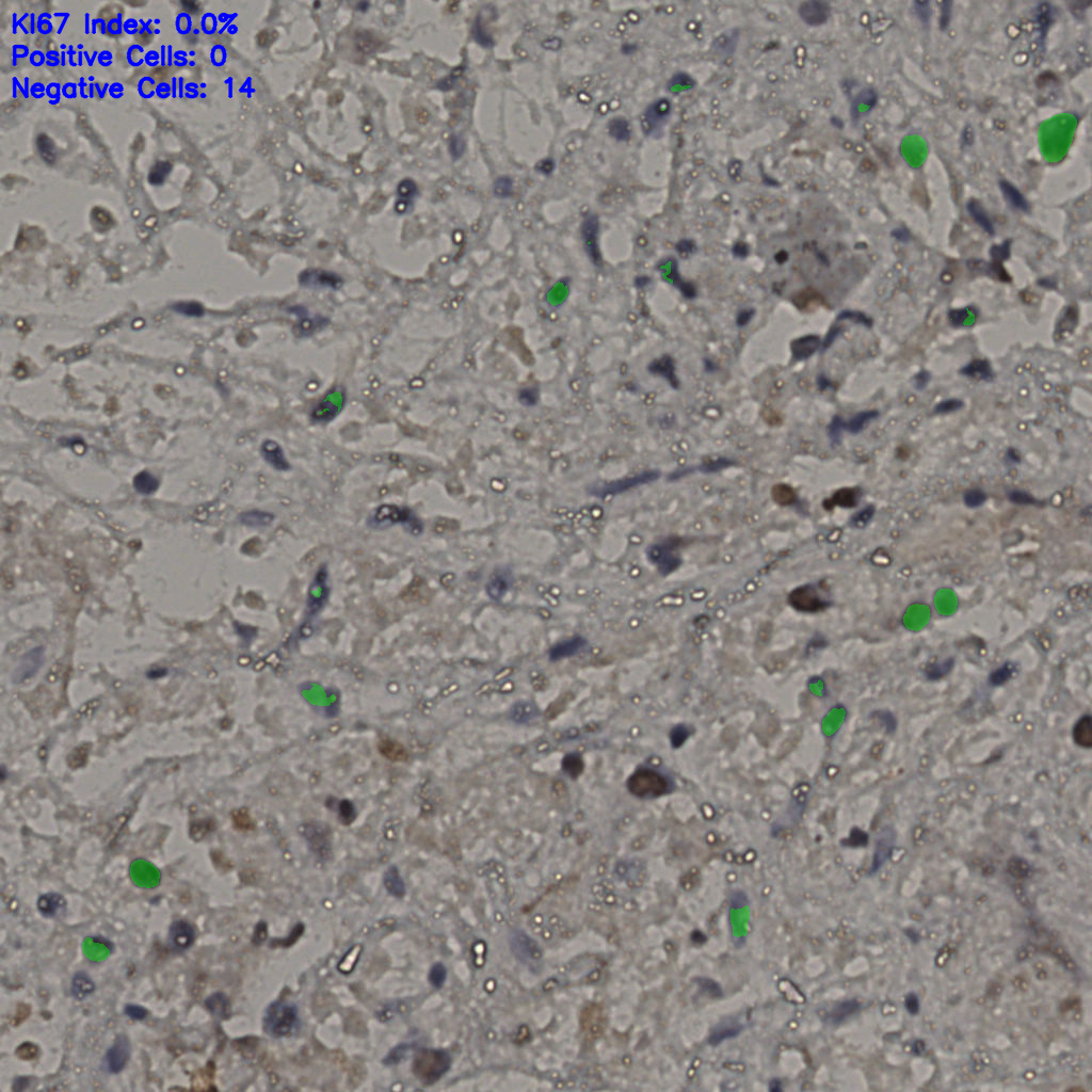 slice_22_33_x19712_y29568.png