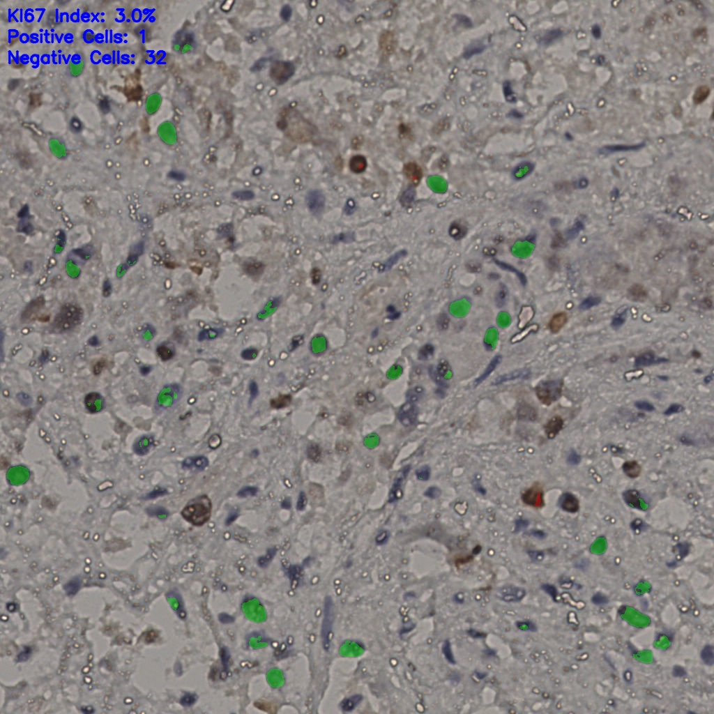 slice_22_34_x19712_y30464.png