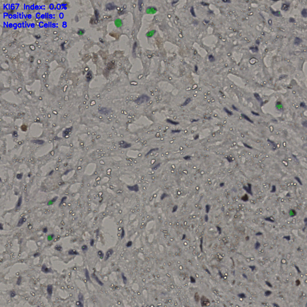 slice_22_35_x19712_y31360.png