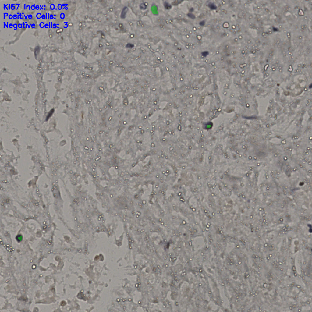 slice_22_37_x19712_y33152.png