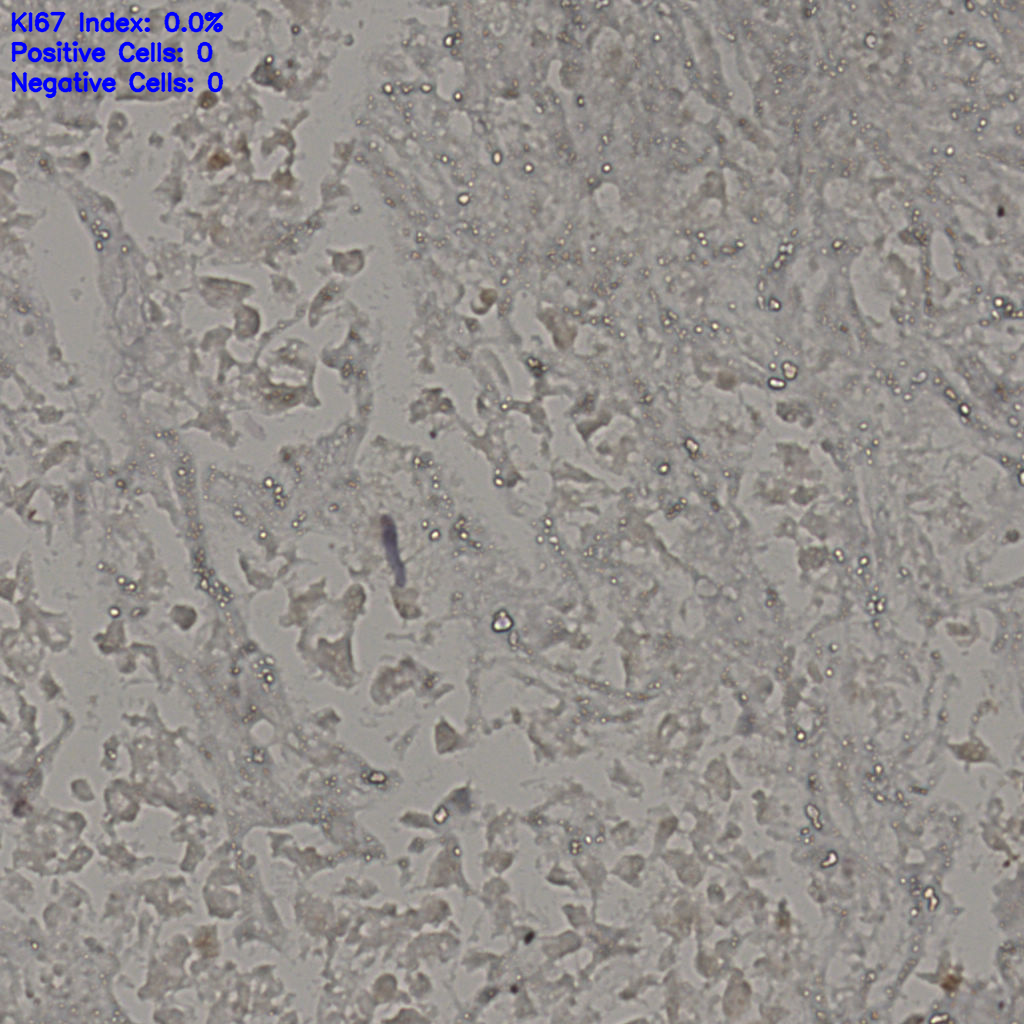 slice_22_38_x19712_y34048.png
