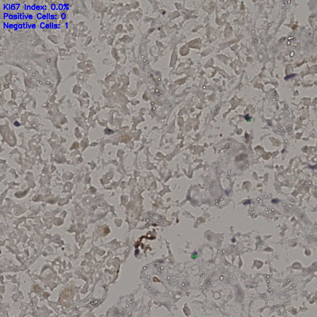 slice_22_39_x19712_y34944.png