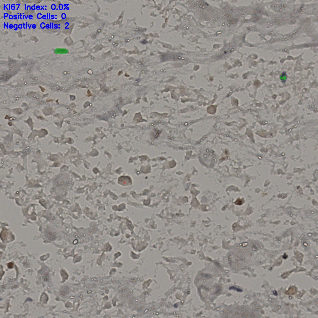 slice_22_41_x19712_y36736.png
