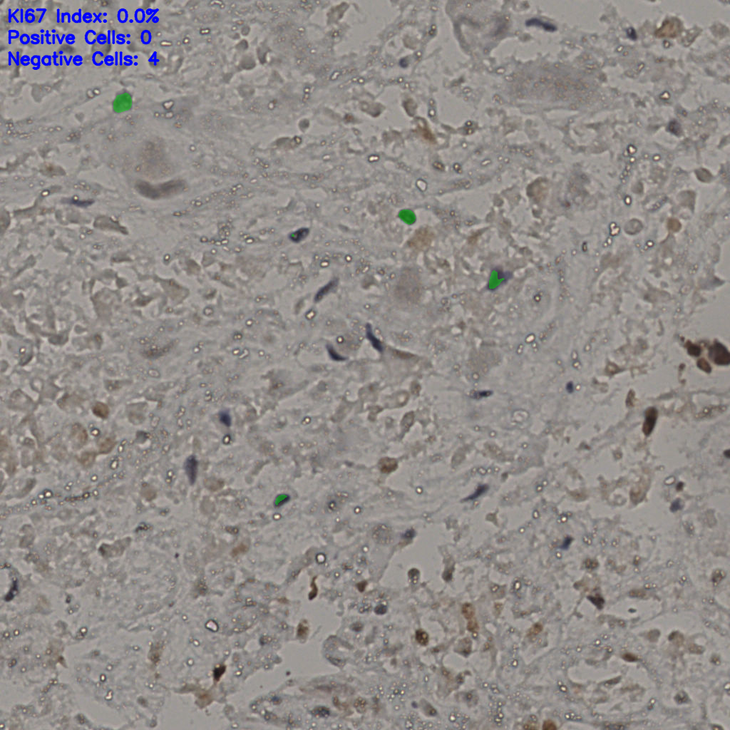 slice_22_42_x19712_y37632.png