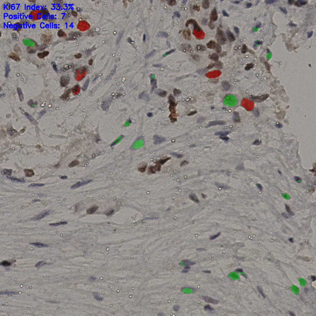 slice_22_49_x19712_y43904.png