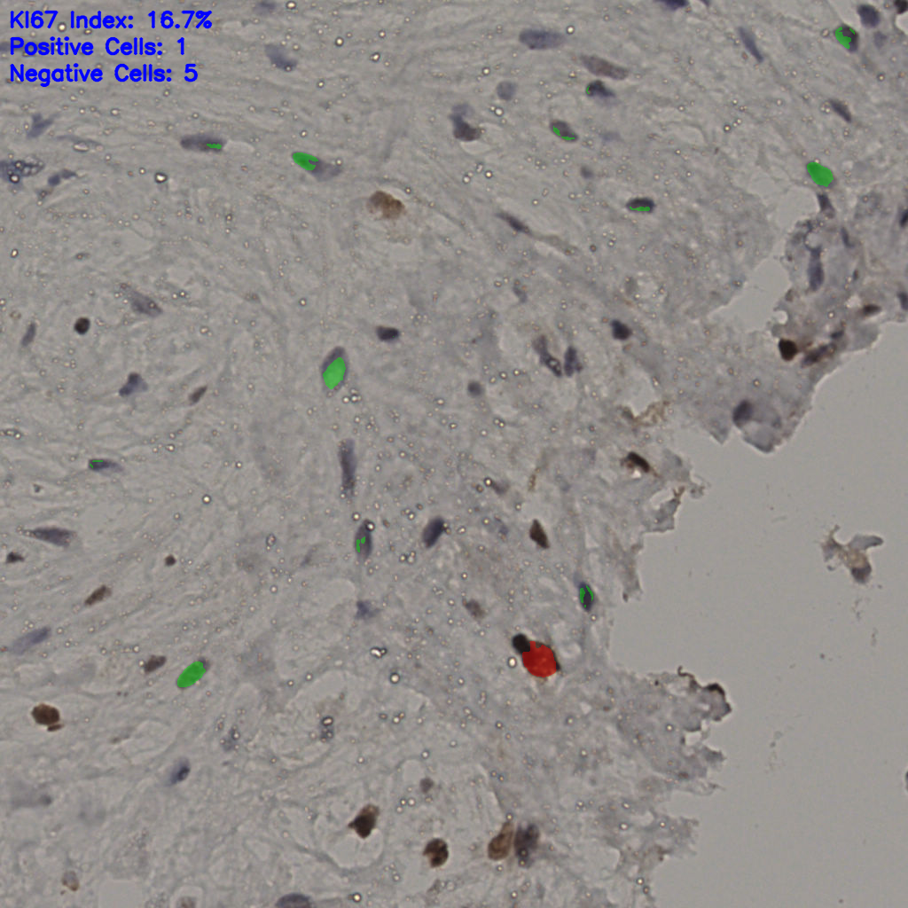 slice_22_50_x19712_y44800.png