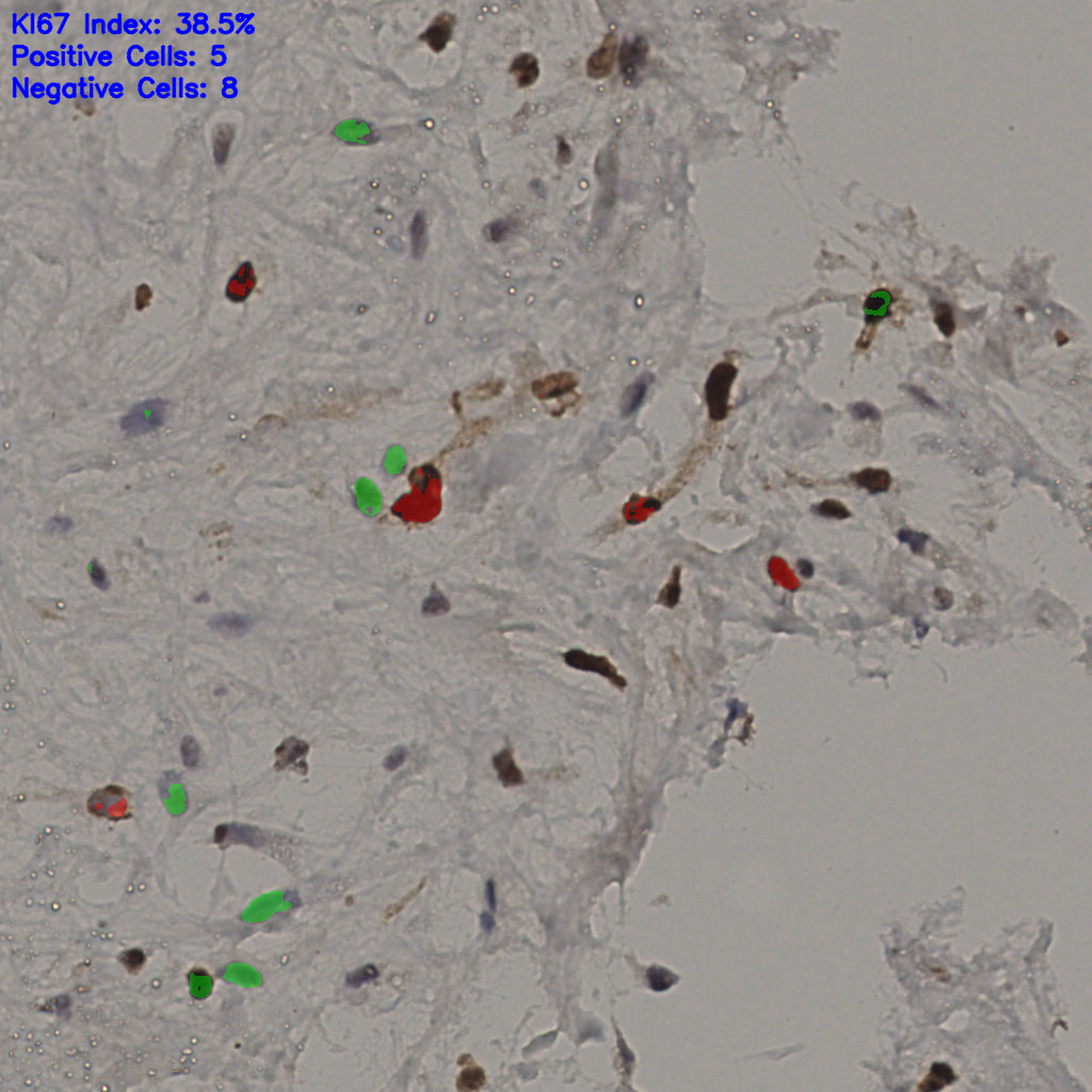 slice_22_51_x19712_y45696.png