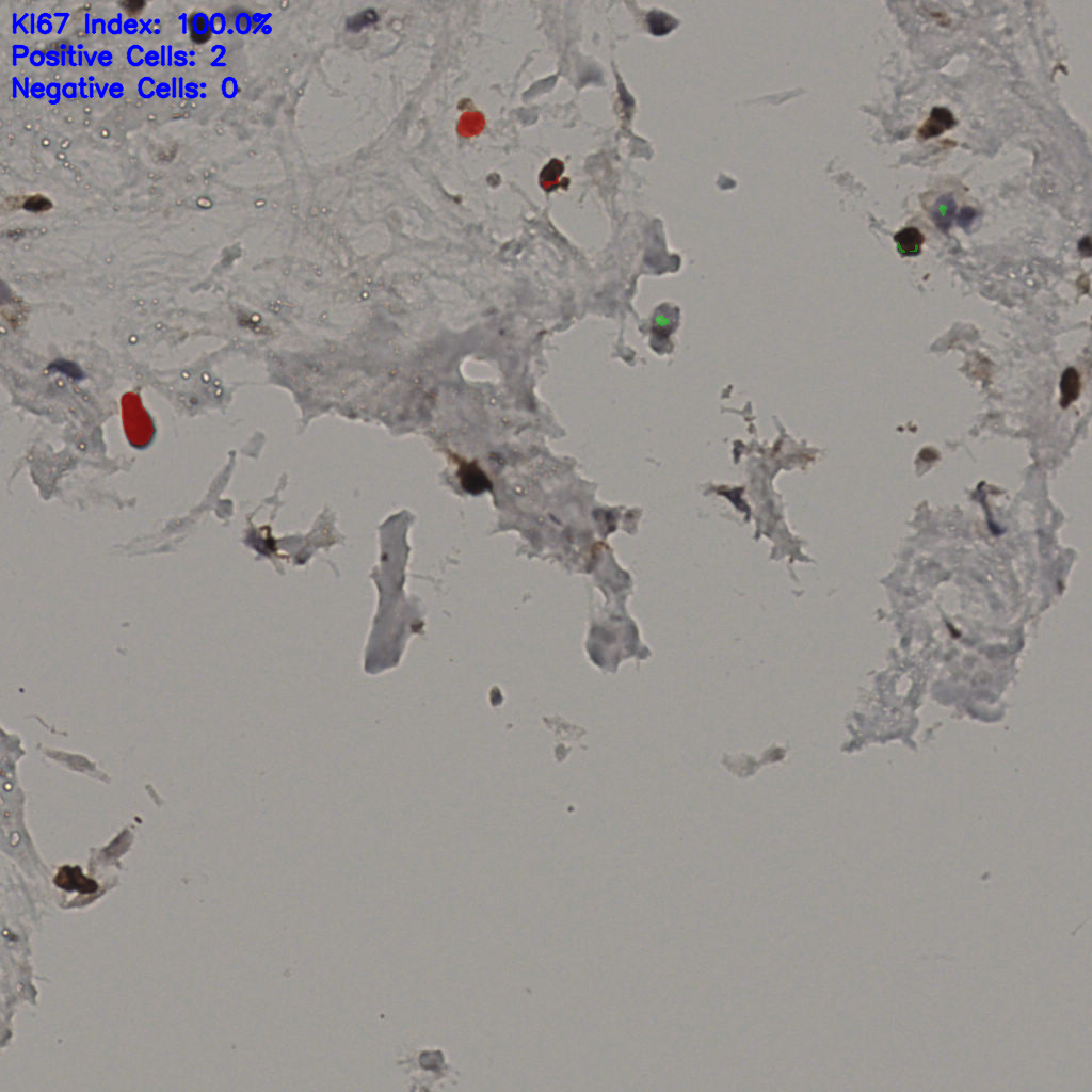 slice_22_52_x19712_y46592.png