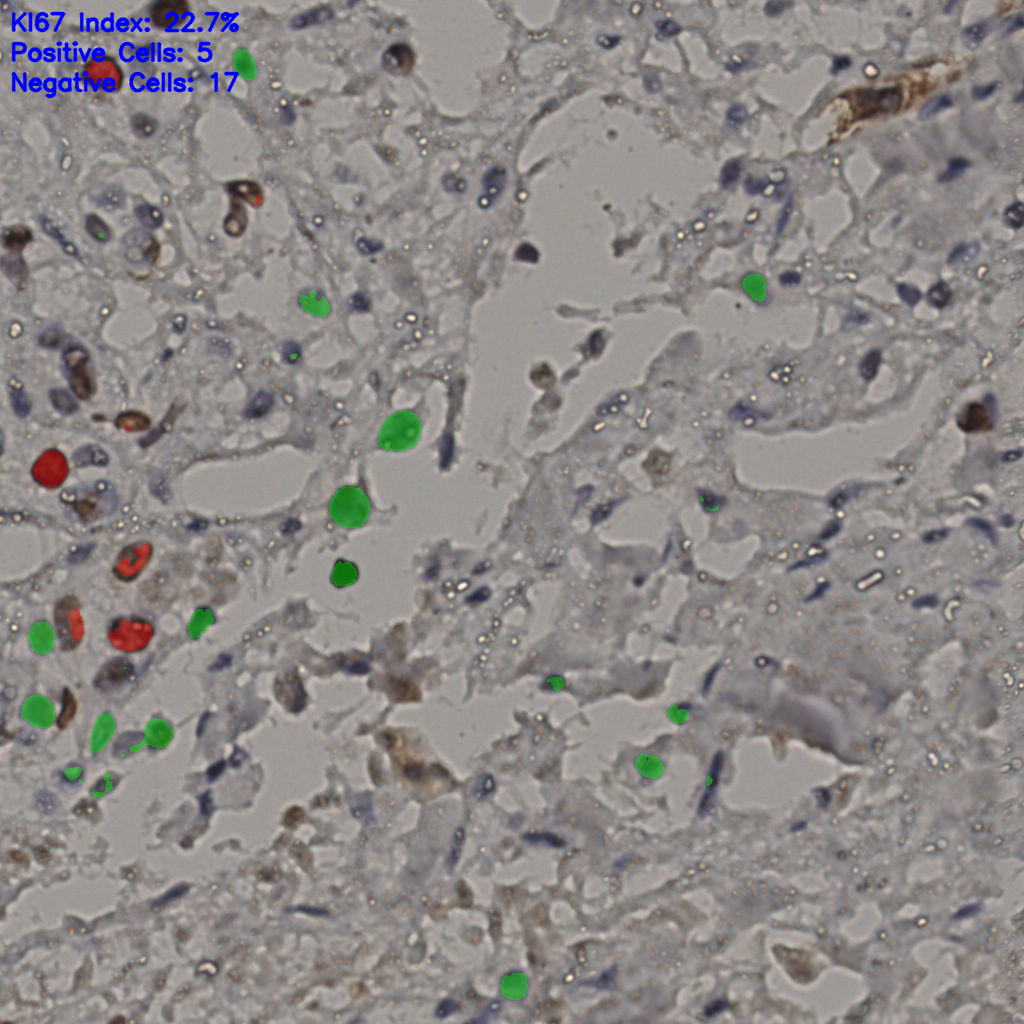 slice_23_27_x20608_y24192.png