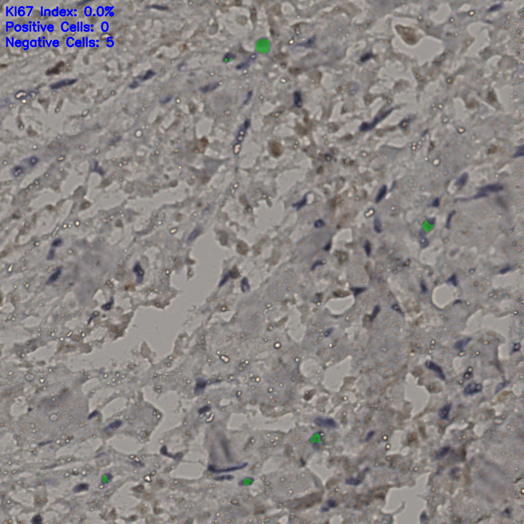 slice_23_28_x20608_y25088.png