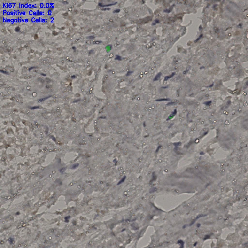 slice_23_29_x20608_y25984.png