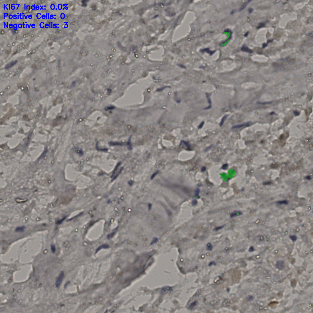 slice_23_30_x20608_y26880.png
