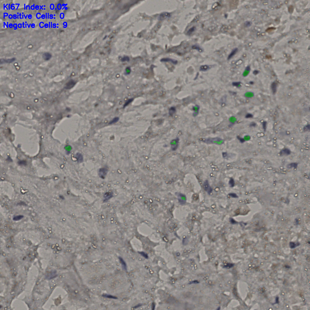 slice_23_31_x20608_y27776.png