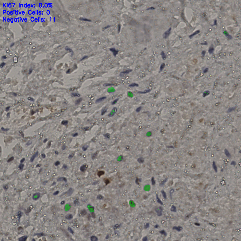 slice_23_32_x20608_y28672.png