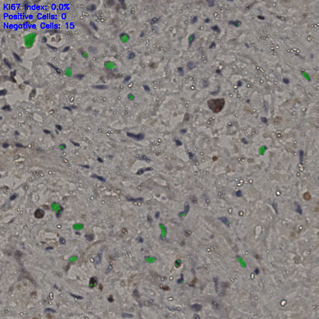 slice_23_33_x20608_y29568.png
