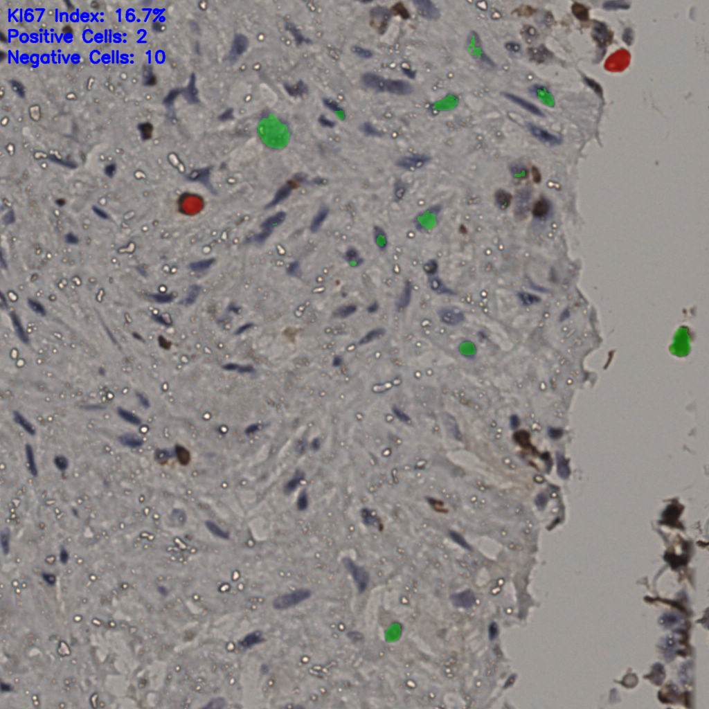 slice_23_36_x20608_y32256.png