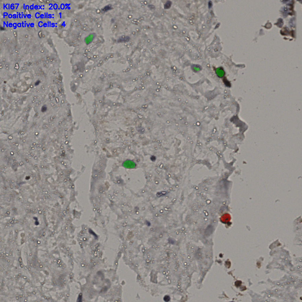 slice_23_37_x20608_y33152.png