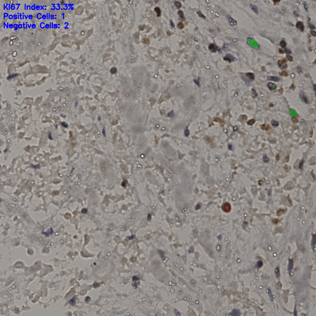 slice_23_39_x20608_y34944.png