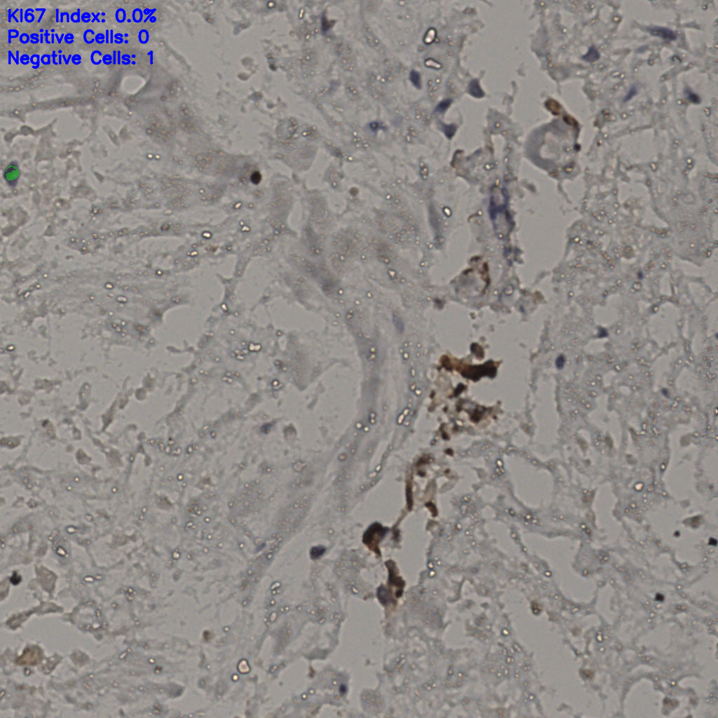 slice_23_41_x20608_y36736.png