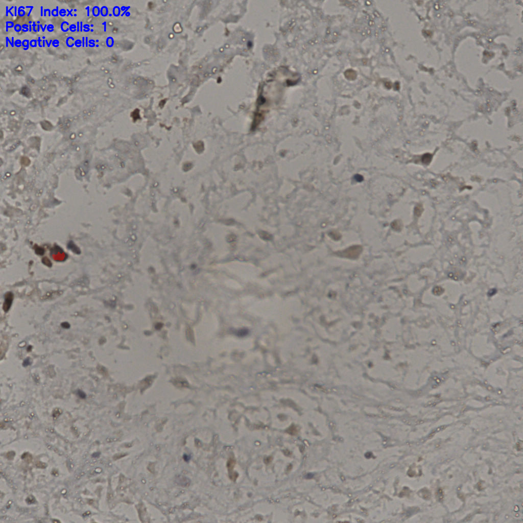 slice_23_42_x20608_y37632.png