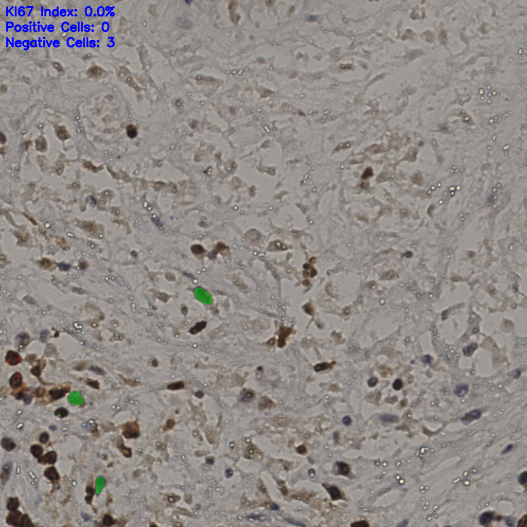 slice_23_43_x20608_y38528.png