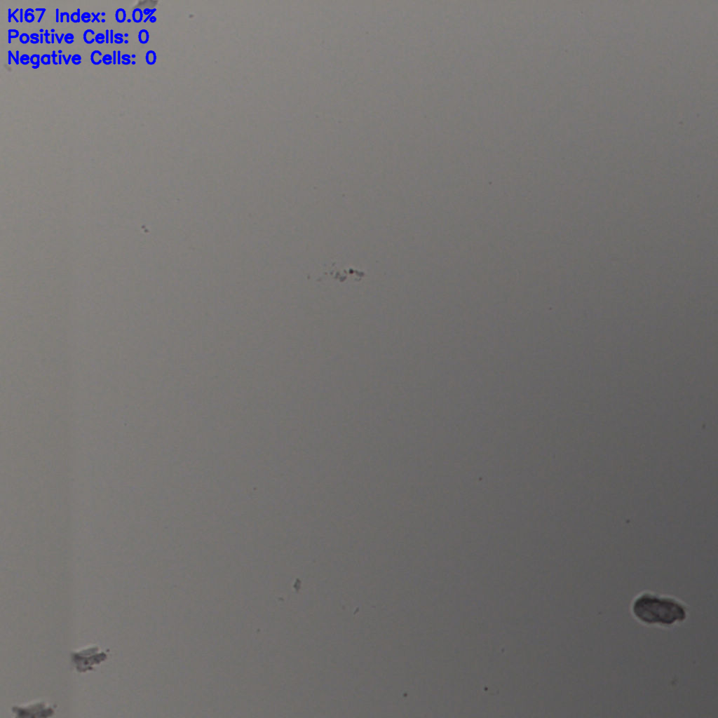 slice_24_20_x21504_y17920.png