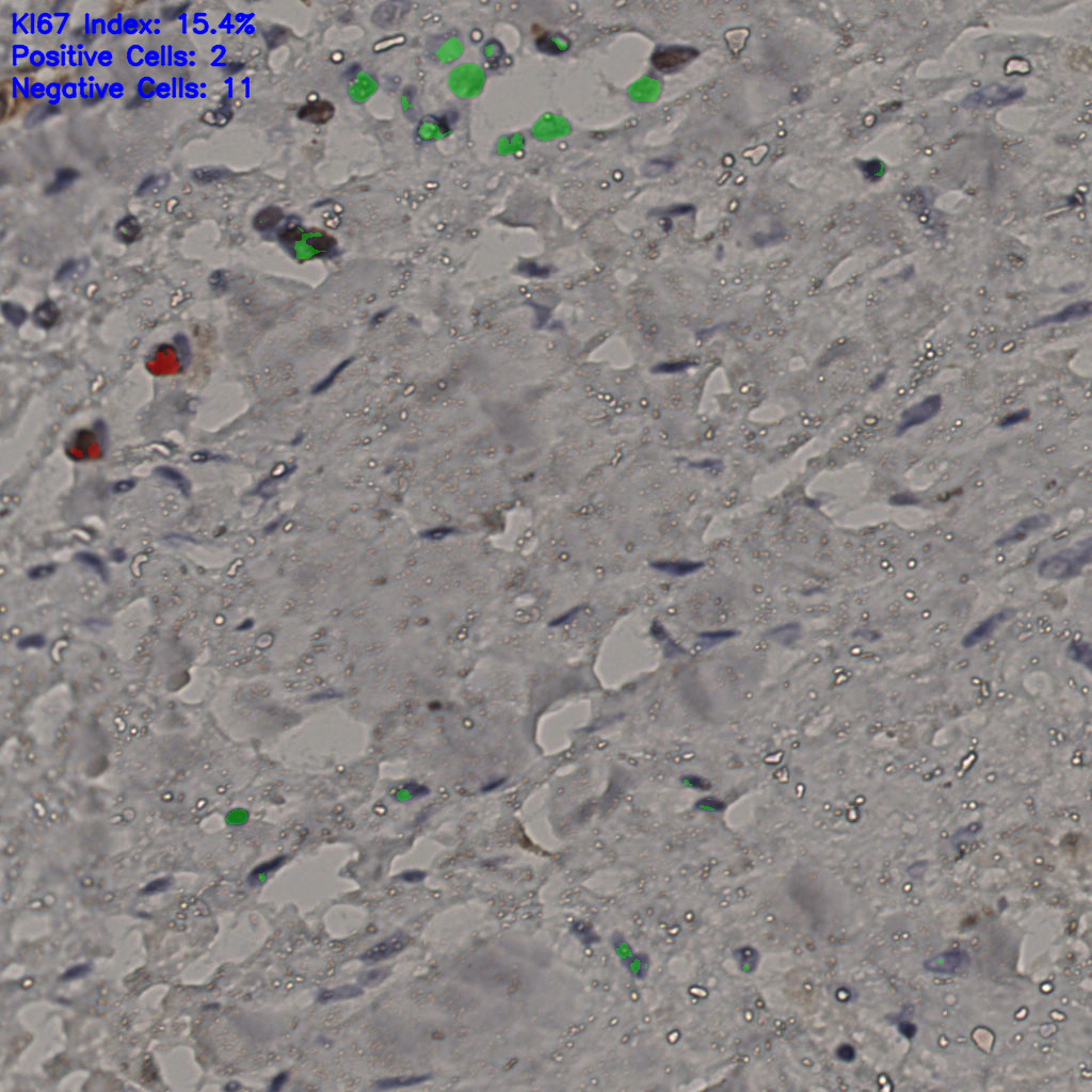 slice_24_27_x21504_y24192.png
