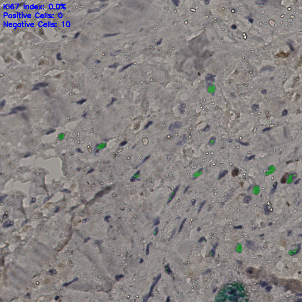 slice_24_28_x21504_y25088.png