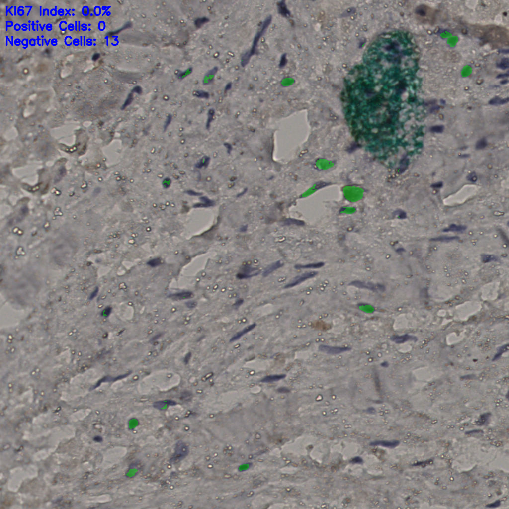 slice_24_29_x21504_y25984.png