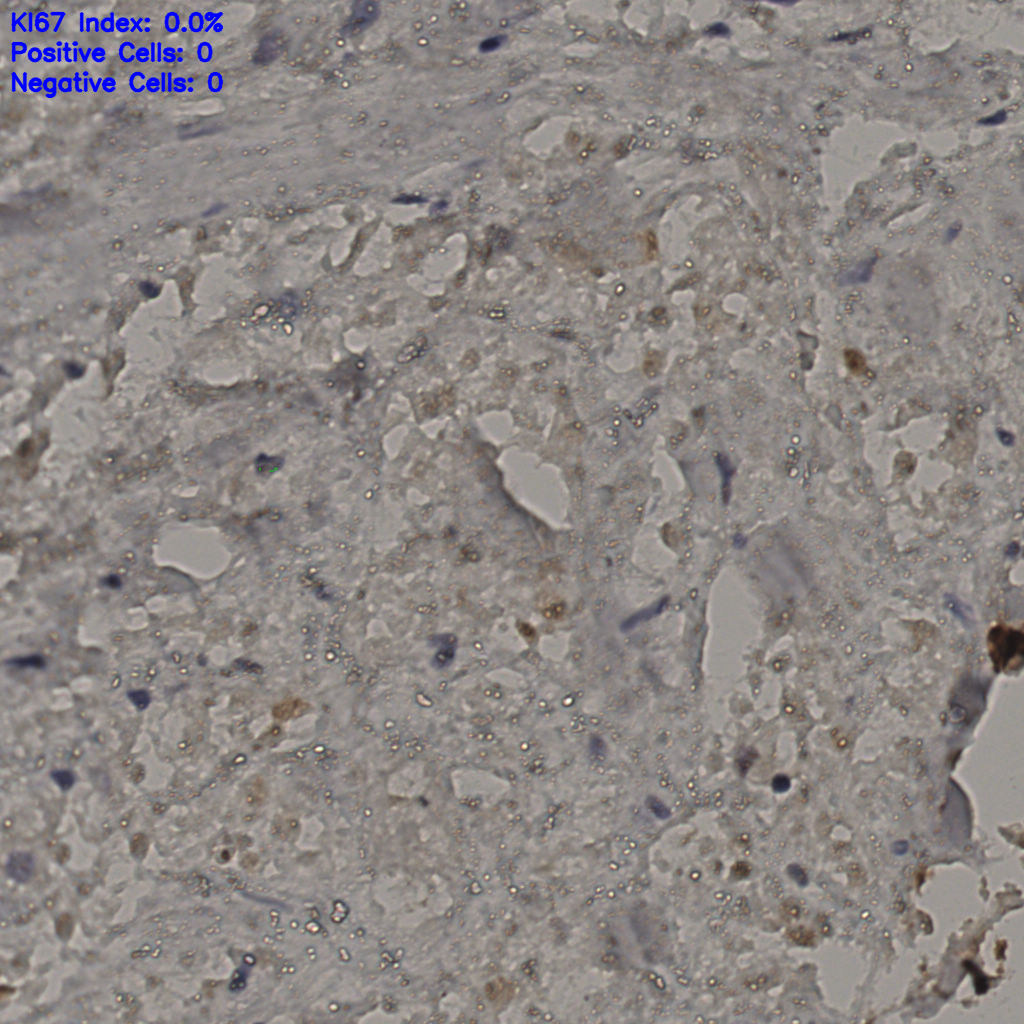 slice_24_30_x21504_y26880.png