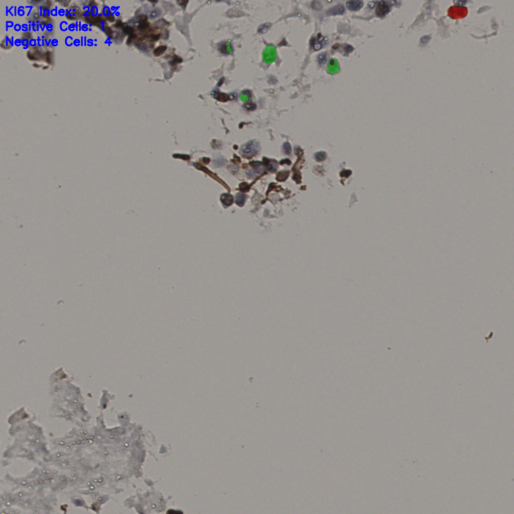 slice_24_37_x21504_y33152.png
