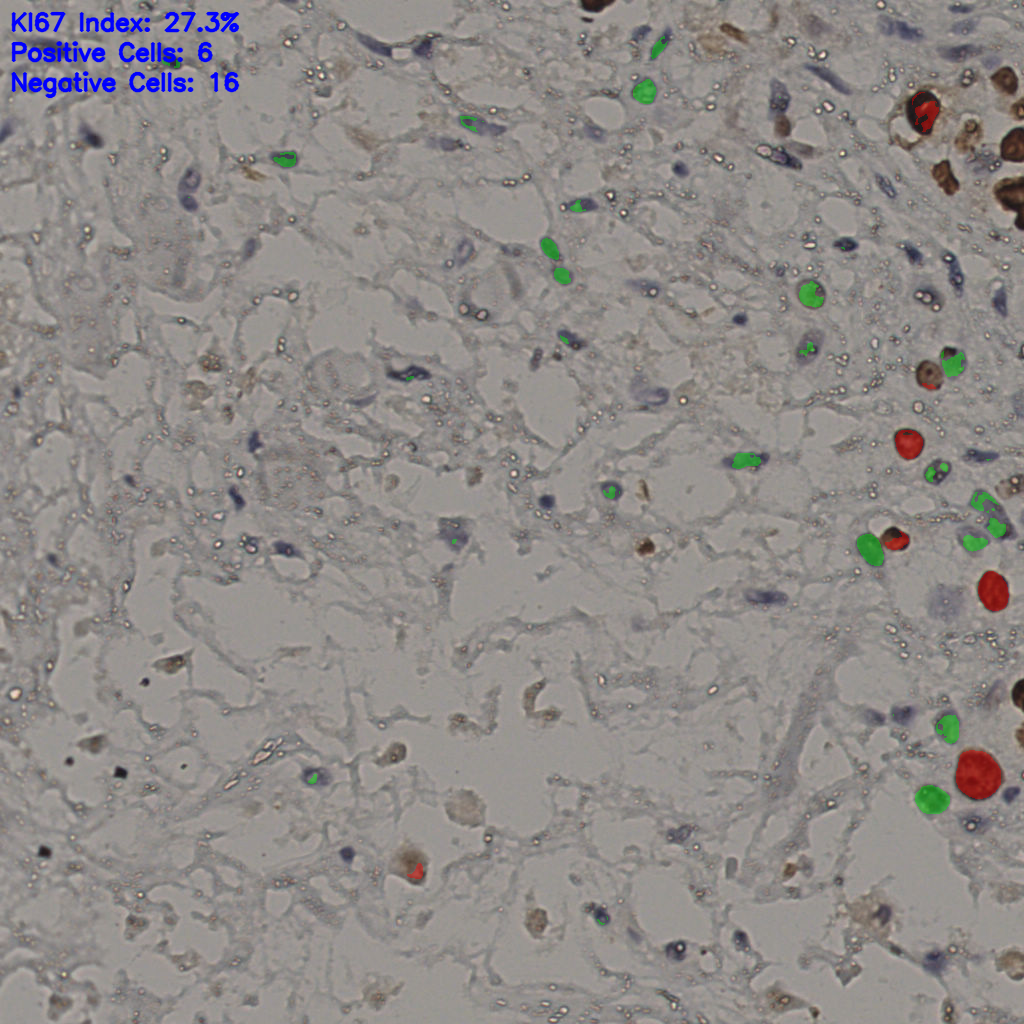 slice_24_41_x21504_y36736.png