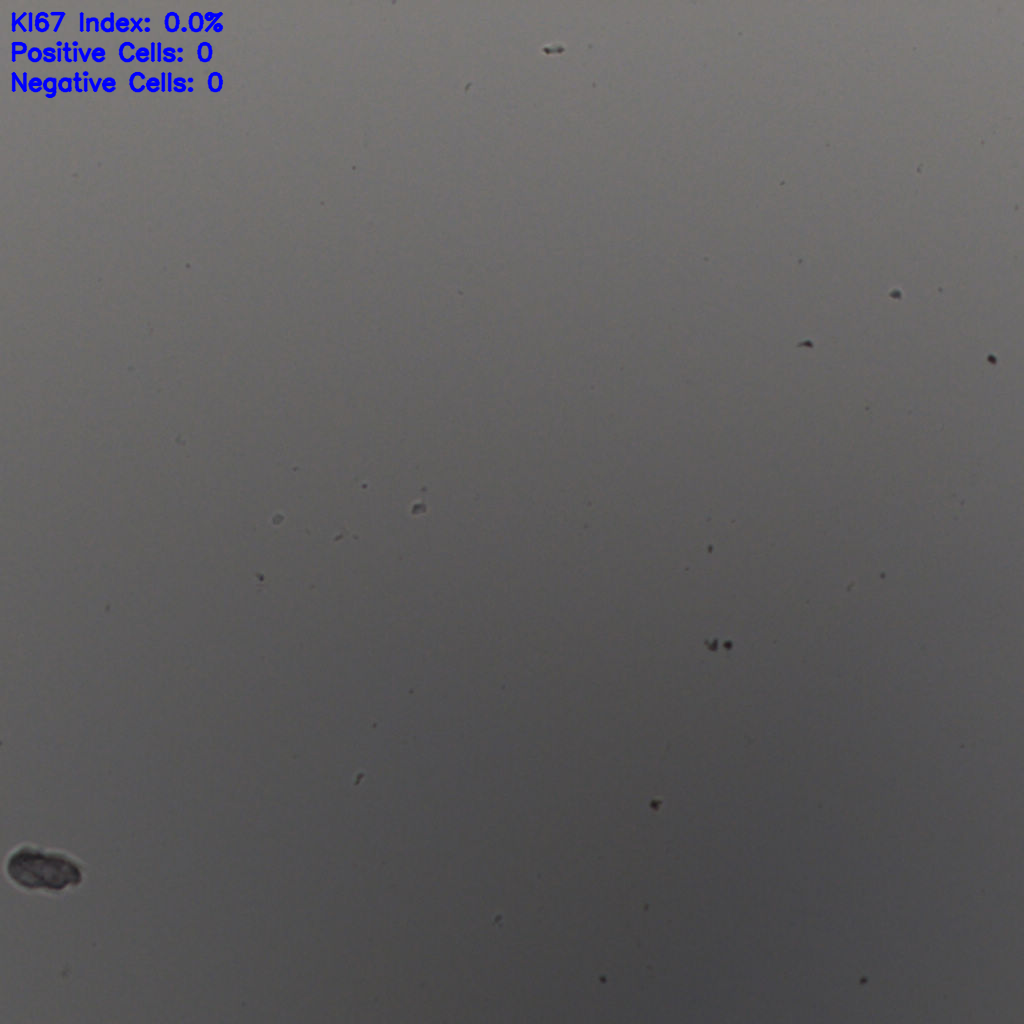 slice_25_20_x22400_y17920.png